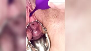 First time cervix play pee hole teasing with speculum