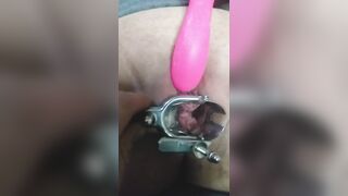 close up speculum and internal veiw of squirting